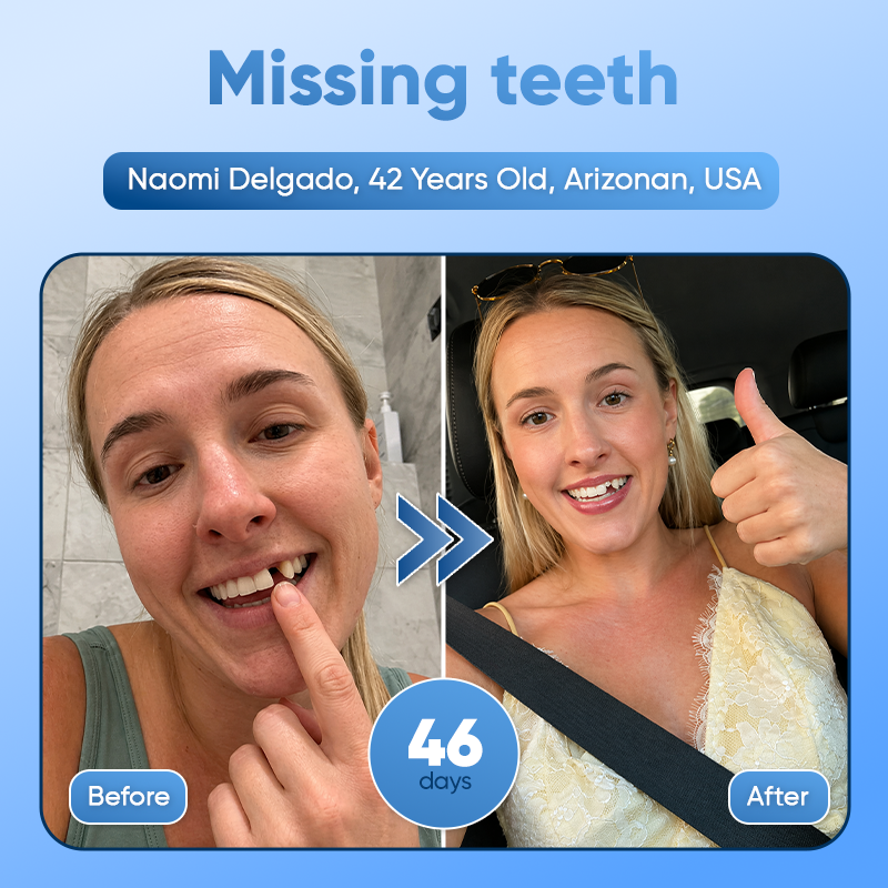 Your Smile🦷Tideglusib Fast‑Dissolving Tooth & Gum Repair Oral Strips✨ (𝟓-𝐢𝐧-𝟏 💎 𝐑𝐞𝐛𝐮𝐢𝐥𝐝 𝐄𝐧𝐚𝐦𝐞𝐥 & 𝐃𝐞𝐧𝐭𝐢𝐧 • 𝐒𝐭𝐫𝐞𝐧𝐠𝐭𝐡𝐞𝐧 𝐆𝐮𝐦𝐬 • 𝐄𝐫𝐚𝐝𝐢𝐜𝐚𝐭𝐞 𝐓𝐚𝐫𝐭𝐚𝐫 & 𝐎𝐝𝐨𝐫 • 𝐖𝐡𝐢𝐭𝐞𝐧𝐢𝐧𝐠 • 𝐒𝐭𝐨𝐩 𝐓𝐨𝐨𝐭𝐡 𝐒𝐞𝐧𝐬𝐢𝐭𝐢𝐯𝐢𝐭𝐲)