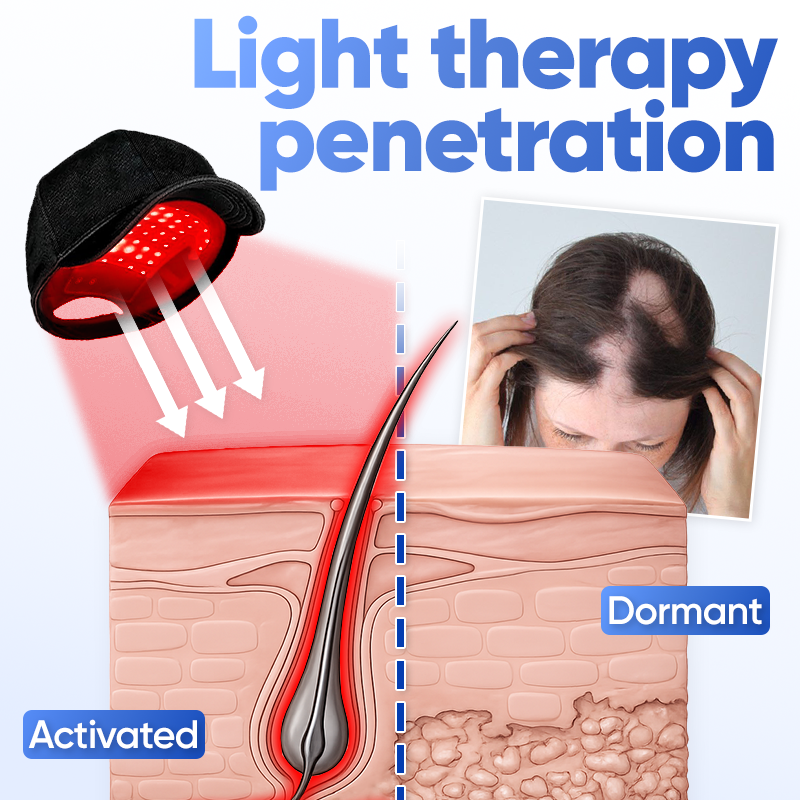 Awaken dormant follicles💇🏻Jhati® FolliPulse Light Therapy Hat