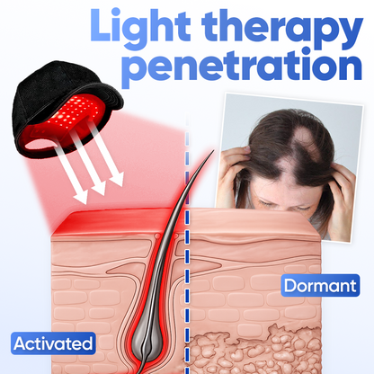 Awaken dormant follicles💇🏻Jhati® FolliPulse Light Therapy Hat