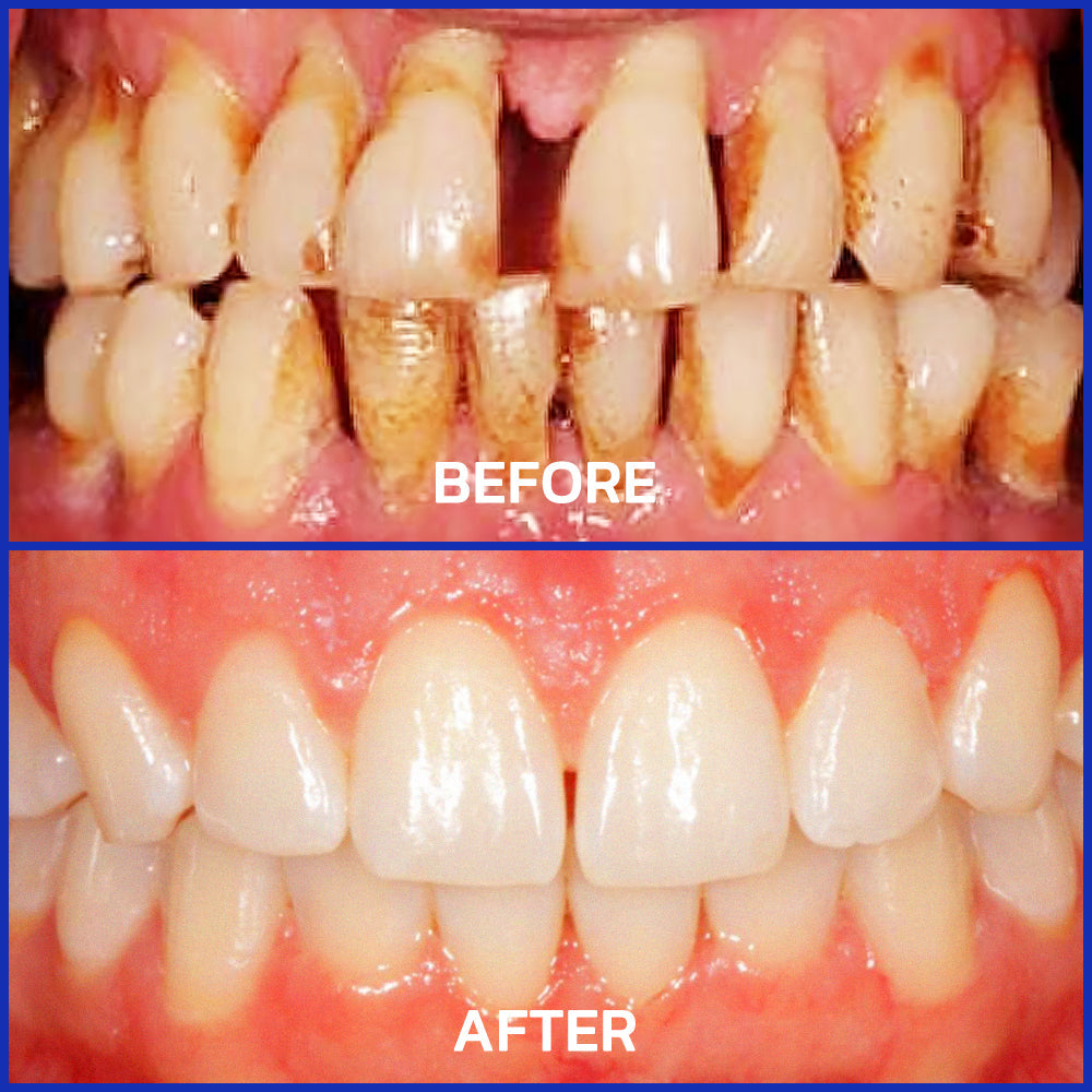 🇬🇧Rolimey® VioCore Bee Venom Dental Treatment Lysozyme Toothpaste