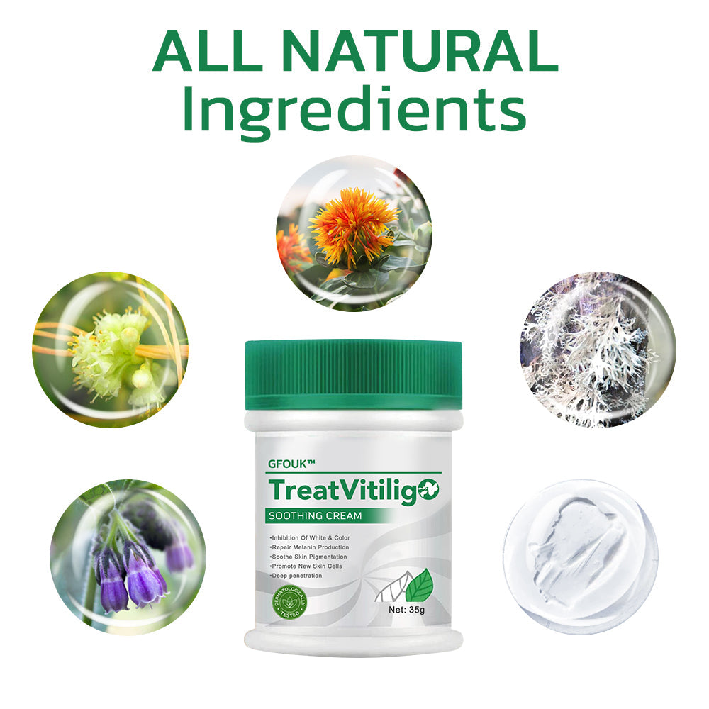 Jhati® TreatVitiligo Soothing Cream