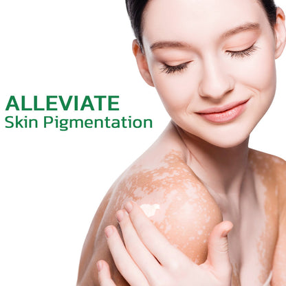Jhati® TreatVitiligo Soothing Cream