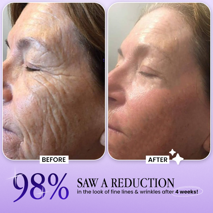 ✨Wrinkle-Lift 💜⬆︎Botox & Vita A Retinol Shot Tightening Cream