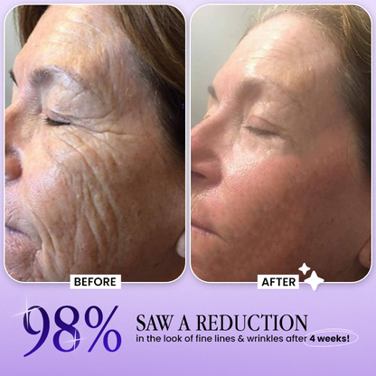 ✨Wrinkle-Lift 💜⬆︎Botox & Vita A Retinol Shot Tightening Cream