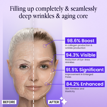 ✨Wrinkle-Lift 💜⬆︎Botox & Vita A Retinol Shot Tightening Cream