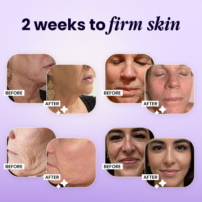 ✨Wrinkle-Lift 💜⬆︎Botox & Vita A Retinol Shot Tightening Cream