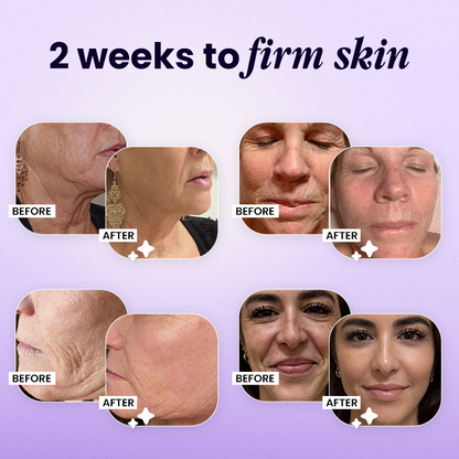 ✨Wrinkle-Lift 💜⬆︎Botox & Vita A Retinol Shot Tightening Cream