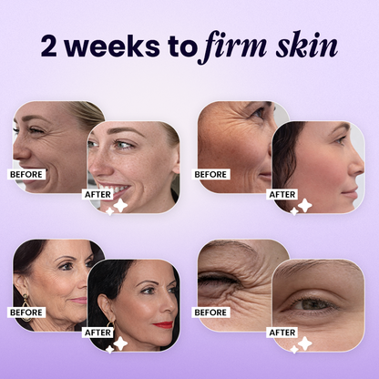 ✨Wrinkle-Lift 💜⬆︎Botox & Vita A Retinol Shot Tightening Cream