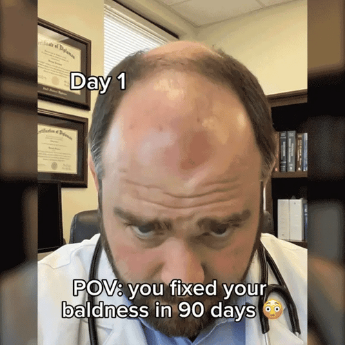 ⭐️Awaken dormant follicles💇🏻Jhati® FolliPulse Light Therapy Hat