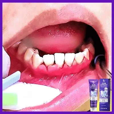 Rolimey® VioCore Bee Venom Dental Treatment Lysozyme Toothpaste🦷
