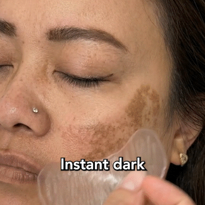 ⭐️Jhati® MicroNeedle Liposome Glutathione Melanin Removal Patches