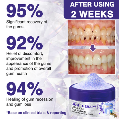 🇬🇧👨🏼‍⚕️Rolimey® VioGloss Bee Venom Dental Therapy Oral Power🦷