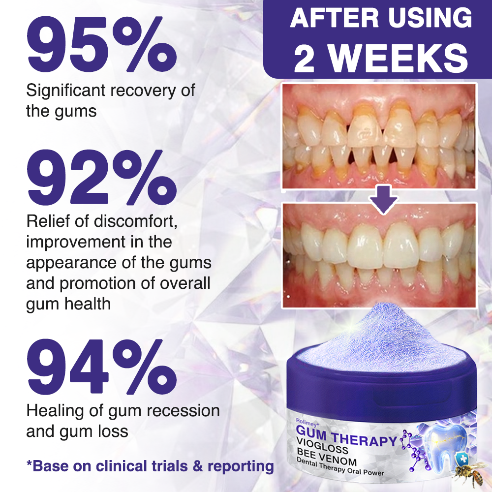 🇬🇧👨🏼‍⚕️Rolimey® VioGloss Bee Venom Dental Therapy Oral Power🦷