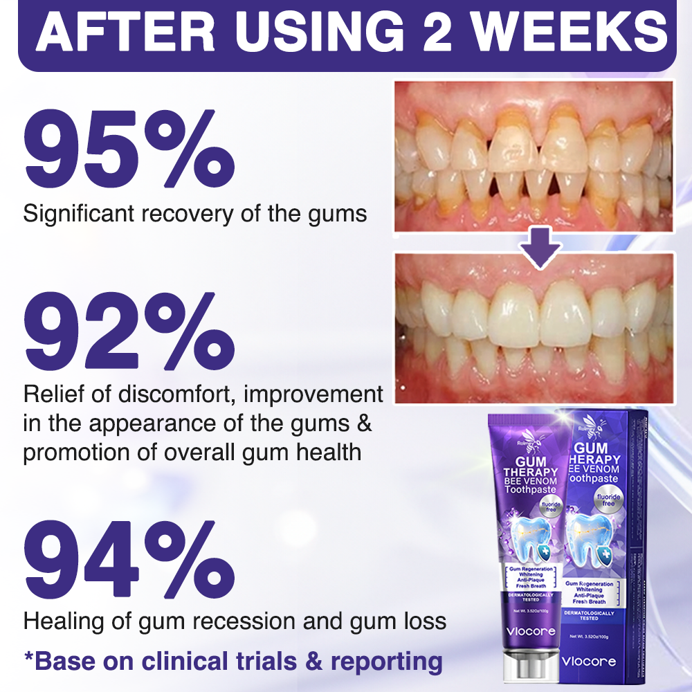 🇬🇧Rolimey® VioCore Bee Venom Dental Treatment Lysozyme Toothpaste