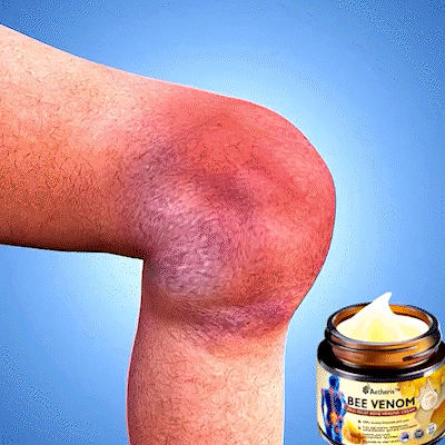 Jhati® Bee Venom Instant Ultra Strength Pain Relief Therapy Cream🔥67% OFF today!
