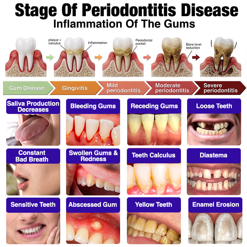 🦷Rolimey® VioCore Bee Venom Gingivitis & Periodontitis Treatment Toothpaste