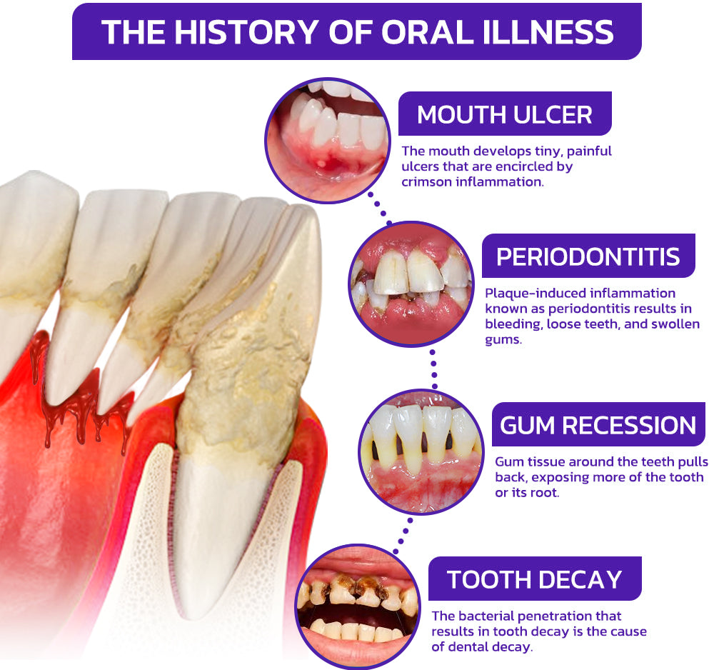 🇬🇧👨🏼‍⚕️Rolimey® VioGloss Bee Venom Dental Therapy Oral Power🦷