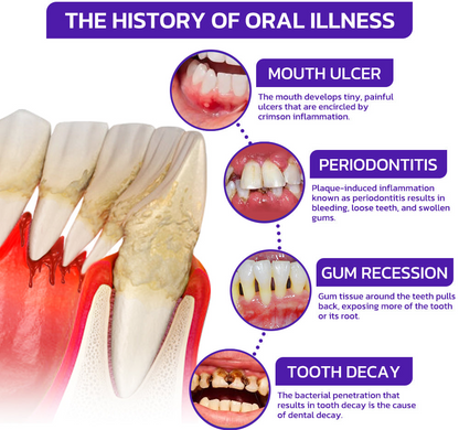 🇬🇧👨🏼‍⚕️Rolimey® VioGloss Bee Venom Dental Therapy Oral Power🦷